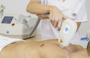 depilación laser sapphire fuengirola